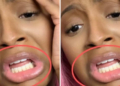 DJ Cuppy advised to go for teeth whitening