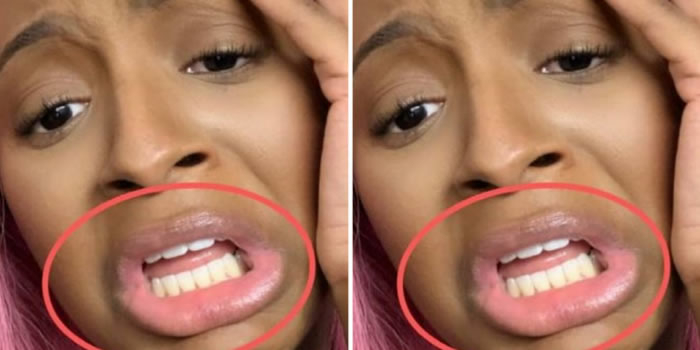 DJ Cuppy advised to go for teeth whitening