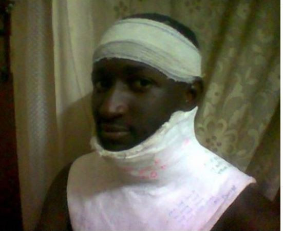 First ever winner of Big Brother Naija,?Katung Aduwak shares photos from a ghastly car crash he survived 15-years ago