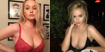 Ex-Playboy model, warn women against the danger of breast enlargement surgery