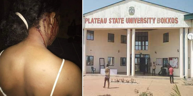 One of the Victim, Plateau State University