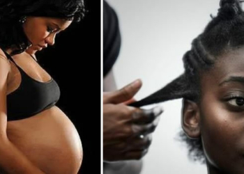 Hair loss during pregnancy