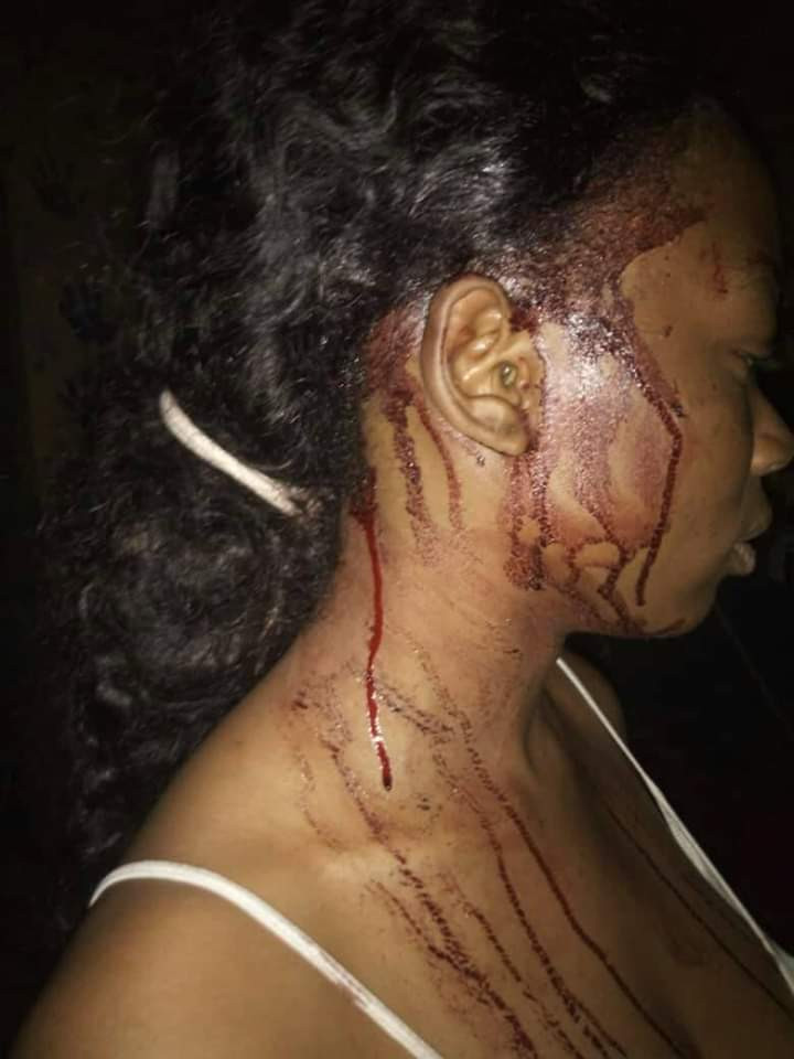 Photos: Students of Plateau State University attacked in their apartments by unknown masked persons