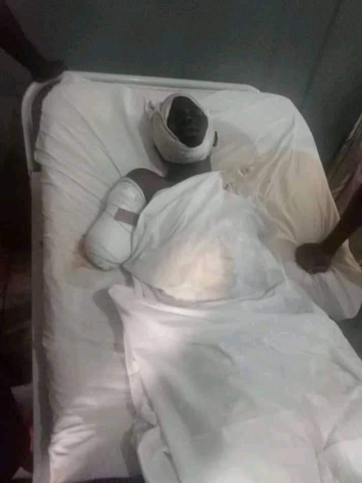 Photos: Corps member who lost both arms in ghastly auto crash to get automatic job, artificial limbs - NYSC DG