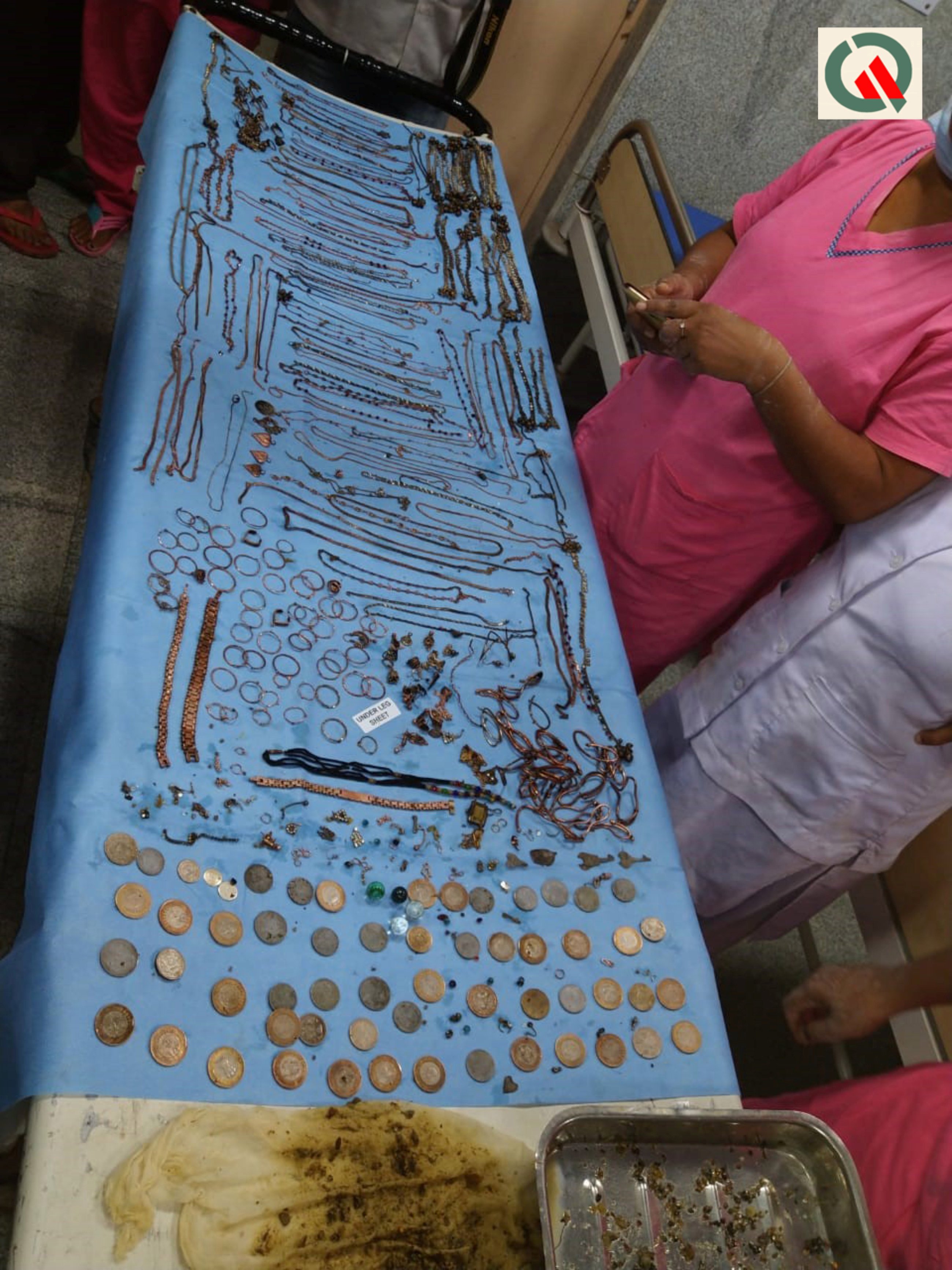 Image result for Doctors Remove 69 Chains, 80 Earrings, 46 Coins From 26-Year-Old Ladyâs