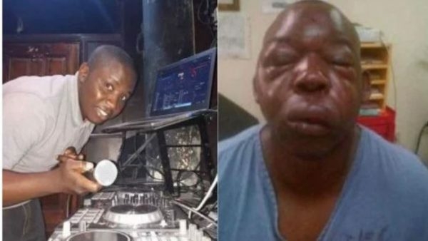 Xenophobia: Zambian DJ beaten