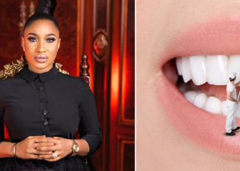 Tonto Dikeh, Teeth whitening [Image for depiction purpose only]