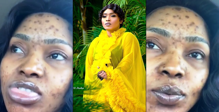 Image result for Halima Abubakar Shares Video Of Her Face Covered With Black Spot