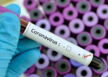Depict of Coronavirus blood sample