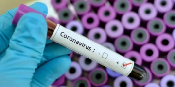 Depict of Coronavirus blood sample