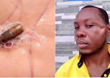 Stray bullet, man who vomited the bullet