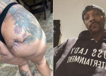 L-R: Lady's butt scarred by cosmetic surgery,  Snoop Dogg