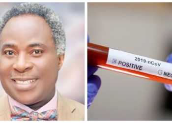 BREAKING: UCH CMD tests positive for coronavirus