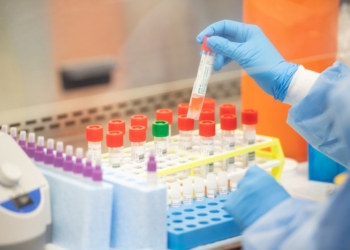 Coronavirus Testing kits heading to the UK contaminated with the disease