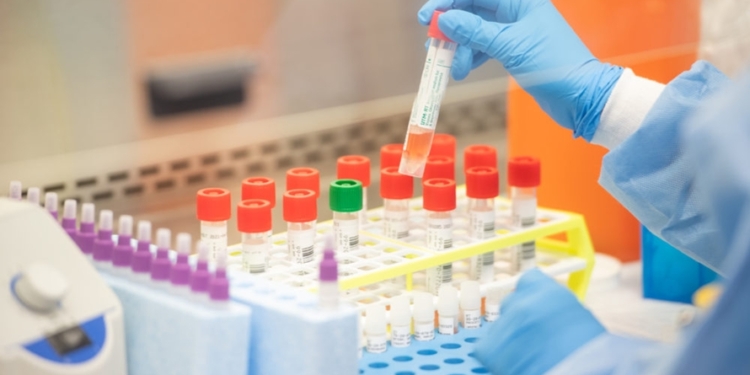 Coronavirus Testing kits heading to the UK contaminated with the disease
