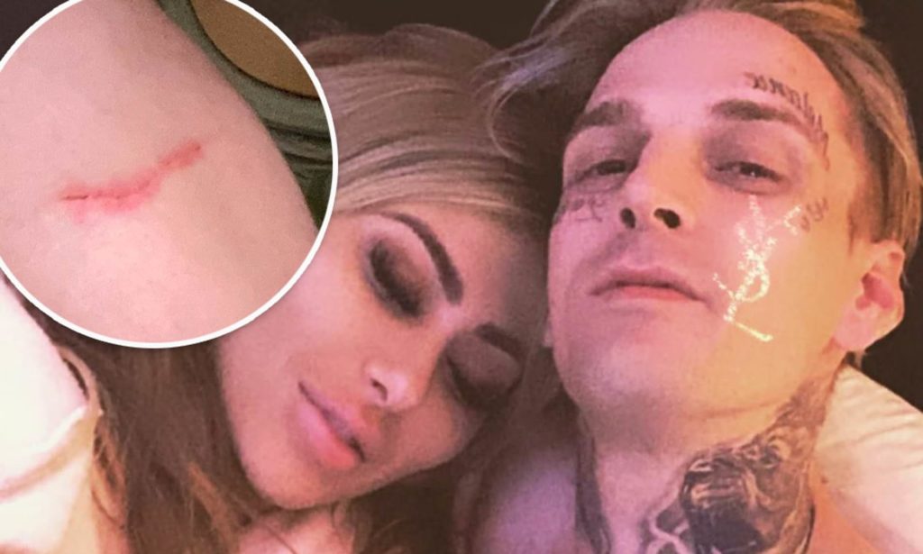 Singer Aaron Carter’s girlfriend arrested for beating him