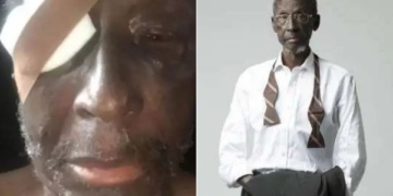 "Veteran Nollywood actor Sadiq Daba is on the verge of losing one of his eyes", journalist claims