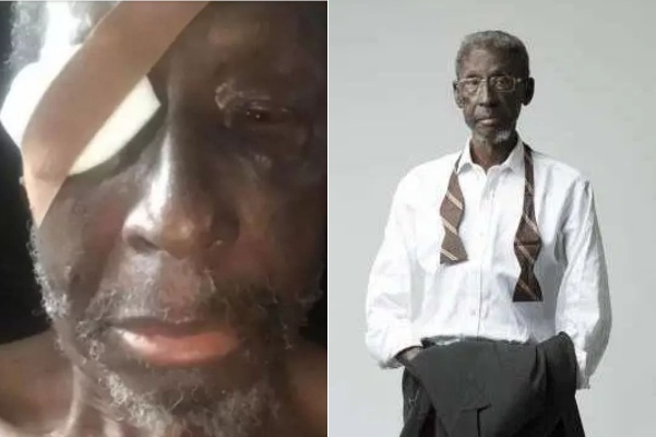 "Veteran Nollywood actor Sadiq Daba is on the verge of losing one of his eyes", journalist claims