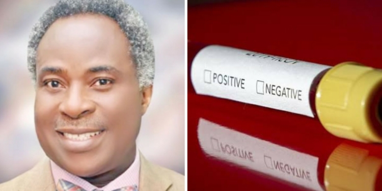 UCH CMD, Prof Jesse Otegbayo tests negative for coronavirus