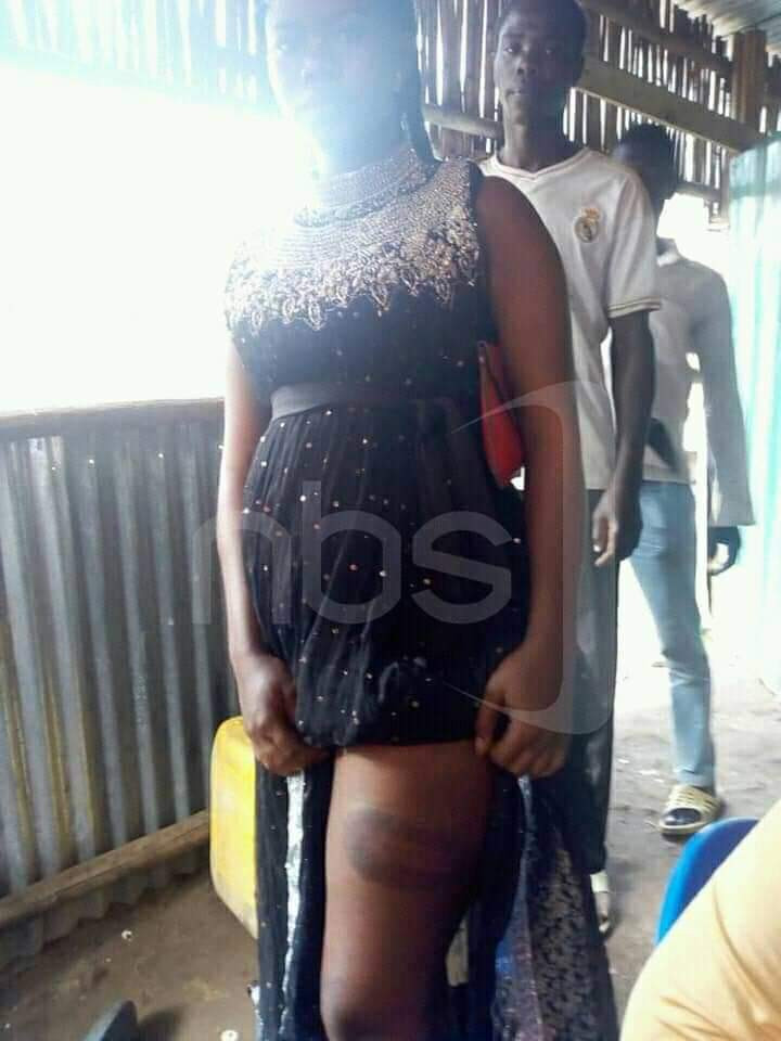 COVID-19 Lockdown: Disturbing photos of women 'tortured' by police officers enforcing curfew at a border