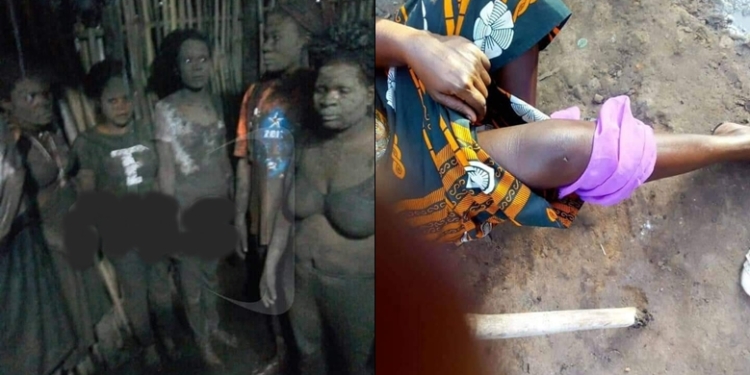 COVID-19 Lockdown: Disturbing photos of women 'tortured' by police officers enforcing curfew at a border