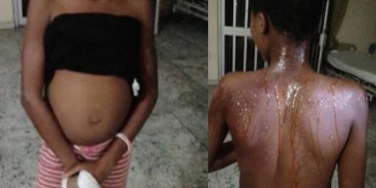 Female police officer accused of dousing her 13-year-year-old niece with hot water in Rivers state