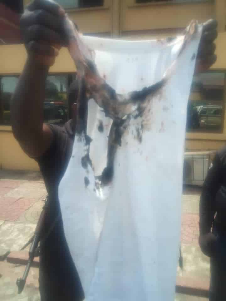 Angry youths bath Policemen with ‘acid’ to avenge death of man shot in Anambra state