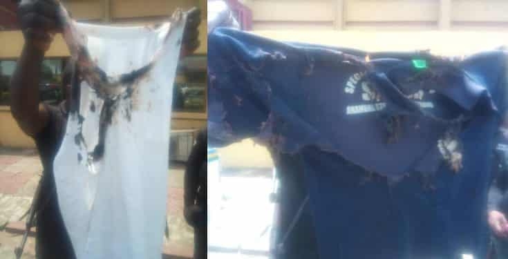 Angry youths bath Policemen with ‘acid’ to avenge death of man shot in Anambra state