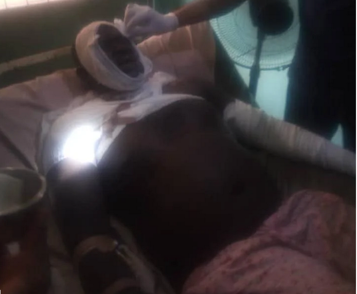 Angry youths bath Policemen with ‘acid’ to avenge death of man shot in Anambra state