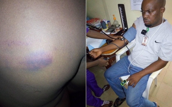 Coronavirus lockdown: NTA staff allegedly brutalized by soldiers in Ondo