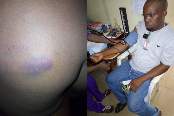 Coronavirus lockdown: NTA staff allegedly brutalized by soldiers in Ondo