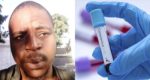 Nigerian man on the run after testing positive for Coronavirus in Ghana