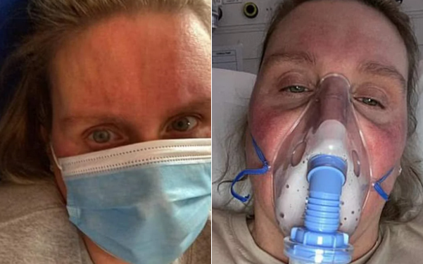 Nurse tests negative for Covid-19 three times despite symptoms