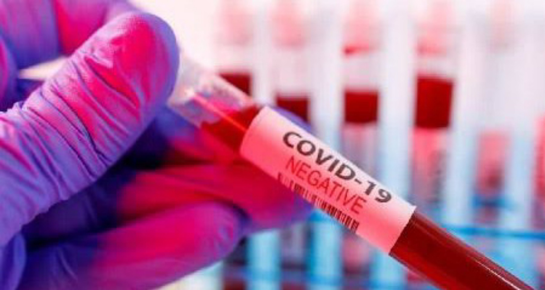 BREAKING: Nigeria Records 38 New COVID-19 Cases, Total Now 665