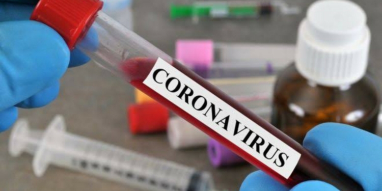 Nigeria records 117 new COVID-19 cases, total now 782