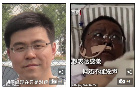 Photos: Chinese doctors who were critically ill with COVID-19 wake up to find that their skin has turned dark