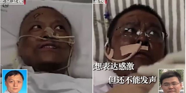 Photos: Chinese doctors who were critically ill with COVID-19 wake up to find that their skin has turned dark