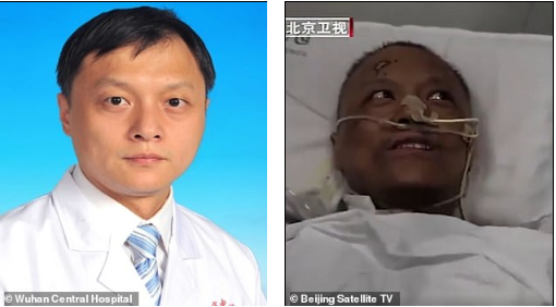 Photos: Chinese doctors who were critically ill with COVID-19 wake up to find that their skin has turned dark