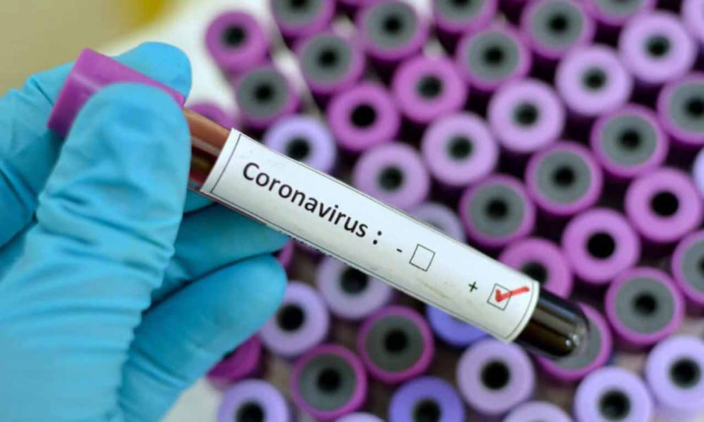 Anambra discharges index case of Coronavirus