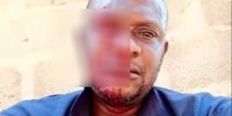 PHCN official attacked while distributing bills in Ogun