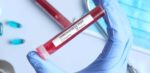 Katsina confirms nine new COVID-19 patients