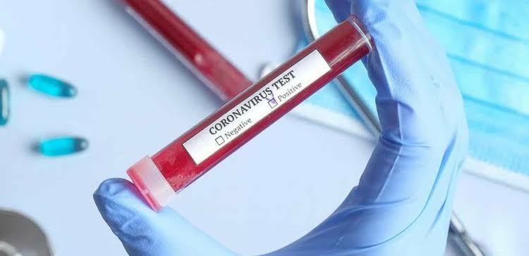 Katsina confirms nine new COVID-19 patients