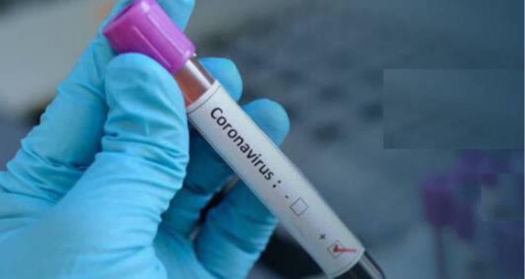 Kebbi records COVID-19 index case