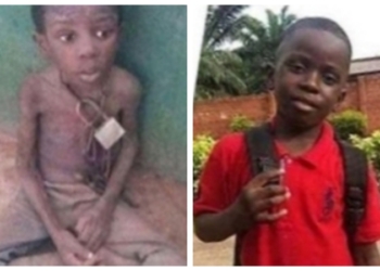 Photo of 9-year-old Ogun boy who was chained and left to die emerges months after Governor's wife adopted him