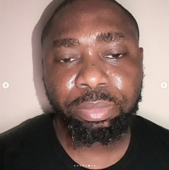 PHOTO: Singer Azadus survives Coronavirus, shares story