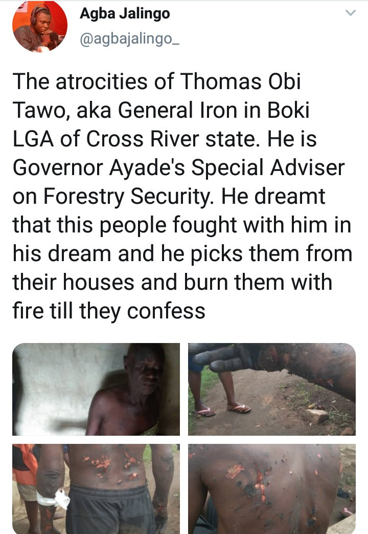 PHOTOS: SA to the Cross River State Governor allegedly burns his subordinates after dreaming he was betrayed