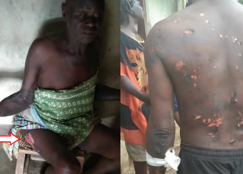PHOTOS: SA to the Cross River State Governor allegedly burns his subordinates after dreaming he was betrayed