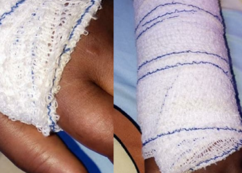 Husband breaks a lady's hand for preventing him from beating his wife