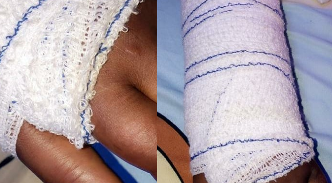 Husband breaks a lady's hand for preventing him from beating his wife