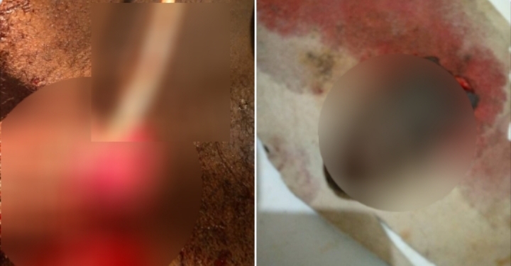 Pregnant woman chops off husband's penis